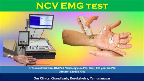 EMG Price in Philippines – Nerve Test With NCV NCS.